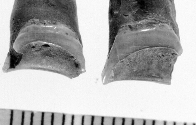 Từ một cái răng 4000 năm tuổi, khoa học giải quyết được câu hỏi khó nhất trong ngành khảo cổ: người chết đã từng làm nghề gì? - Ảnh 2.
