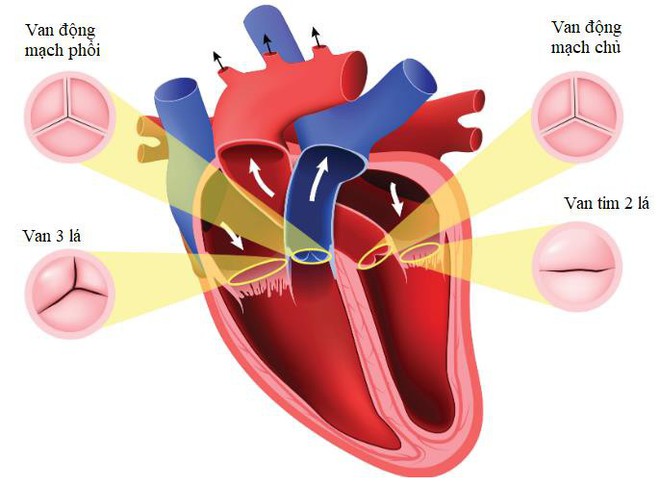 Nhận biết triệu chứng hở van tim để sớm giảm mệt mỏi, khó thở - Ảnh 1.