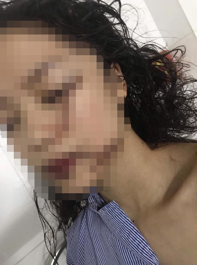Cô gái 18 tuổi bị nhóm bạn xông vào phòng trọ rạch mặt, khâu 60 mũi ở Bắc Ninh - Ảnh 1.