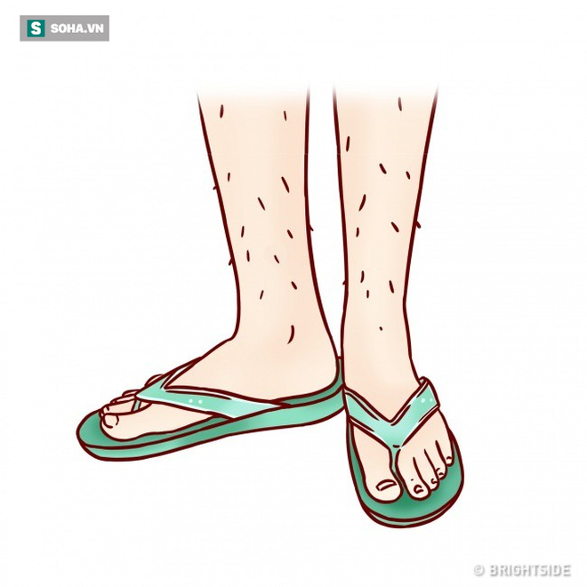 10 sai lầm dễ mắc khi lựa chọn giày dép trong mùa hè: Nếu chủ quan sẽ rước bệnh vào thân - Ảnh 3.