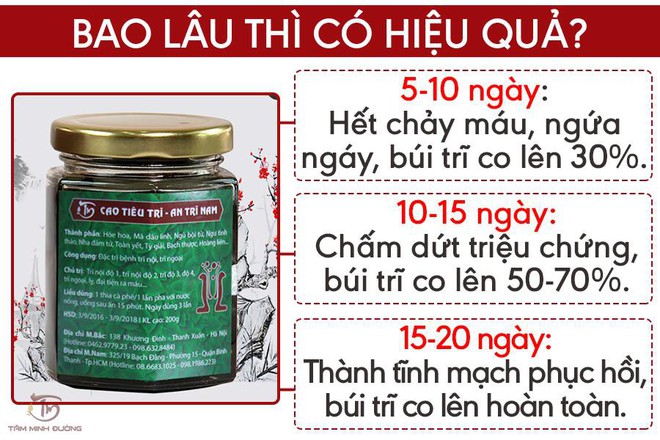 Trĩ nội - Trĩ ngoại: Nguyên nhân, dấu hiệu và cách chữa bệnh dễ dàng - Ảnh 5.