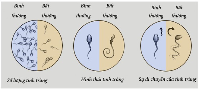 4 yếu tố có thể khiến tinh trùng bất thường, dị dạng: Mọi nam giới đều nên biết để tránh - Ảnh 1.