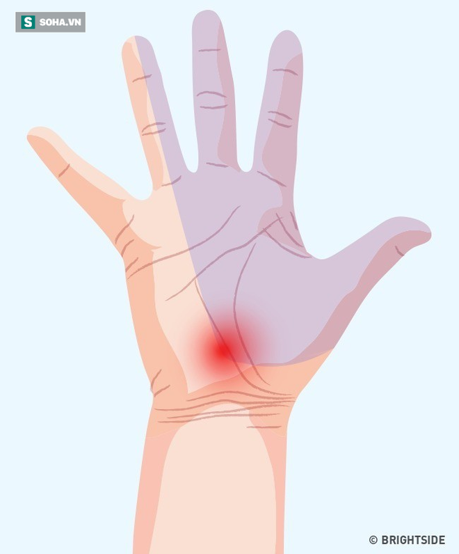 3 dấu hiệu bất thường ở tay chân: 80% khả năng bạn bị tắc mạch máu, nên xử lý ngay - Ảnh 4.