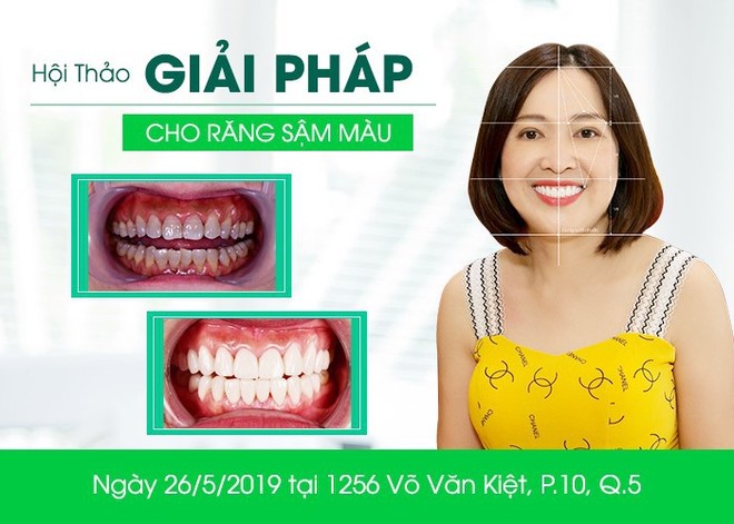 Giải pháp cho hàm răng sậm màu, nhiễm Tetra - Ảnh 1.