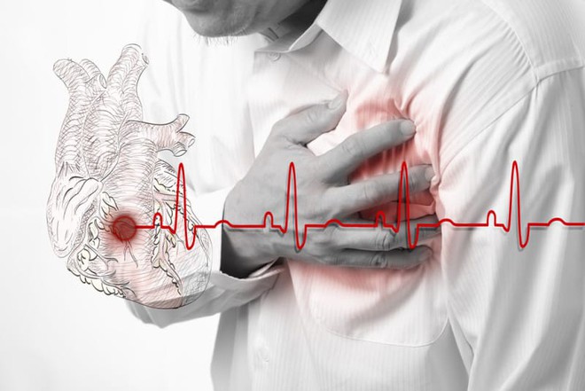 4 dấu hiệu cảnh báo tim của bạn đã gặp nguy hiểm: Hãy nhanh đi khám để tránh rủi ro - Ảnh 3.