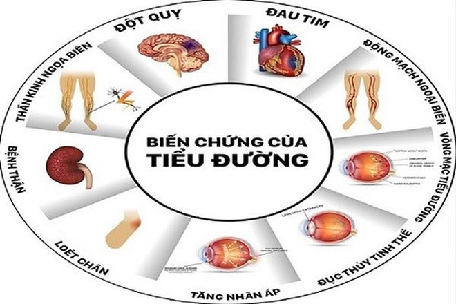 Những sai lầm người bị đái tháo đường hay mắc phải - Ảnh 1.