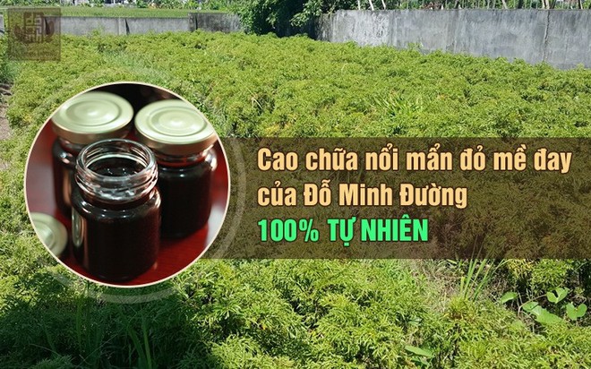 Nổi mẩn đỏ ngứa da là bệnh gì? Nguyên nhân, triệu chứng và cách chữa hiệu quả - Ảnh 4.