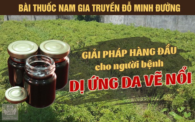 Dị ứng da vẽ nổi: Nguyên nhân, triệu chứng và cách chữa an toàn từ thảo dược - Ảnh 3.