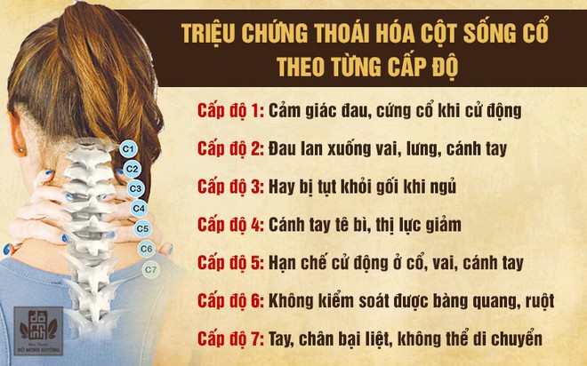 Thoái hóa đốt sống cổ là gì? Nguyên nhân, triệu chứng và cách chữa hiệu quả - Ảnh 1.