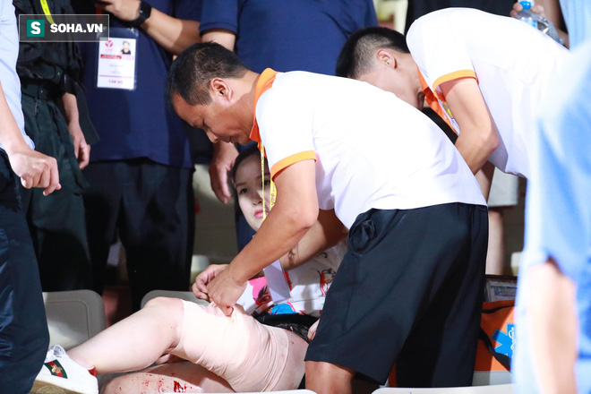 Sếp CLB Nam Định gửi lời xin lỗi tới nạn nhân của vụ đốt pháo sáng tại SVĐ Hàng Đẫy - Ảnh 1.