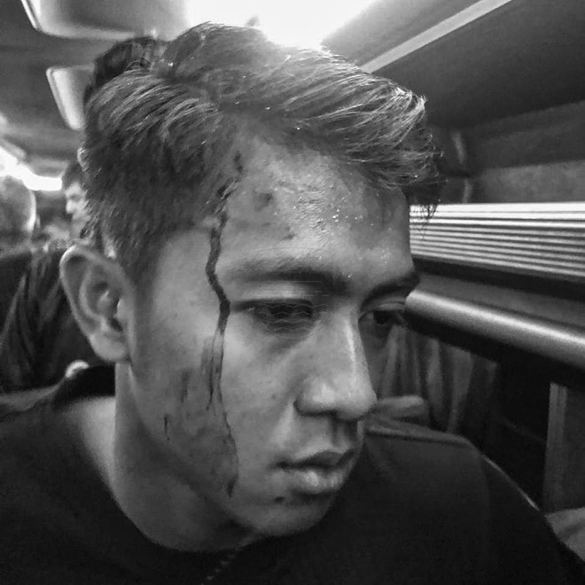 Bóng đá Indonesia lại rúng động: Cầu thủ bị CĐV ném đá vỡ đầu, thoát chết trong gang tấc - Ảnh 3.