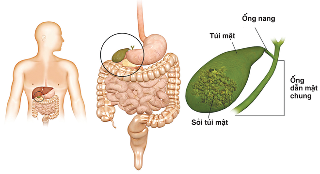 Lạc là món ăn rất tốt cho sức khỏe, nhưng 4 nhóm người này lại không nên ăn - Ảnh 3.