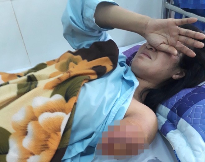 Cô giáo đi xe máy 130km dạy học bị tai nạn không dám nhìn cánh tay bị dập nát của mình - Ảnh 1.