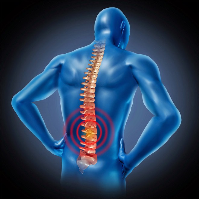 Nam giới đau lưng có phải bị mắc bệnh thận không: 4 yếu tố liên quan cần xem xét ngay - Ảnh 4.