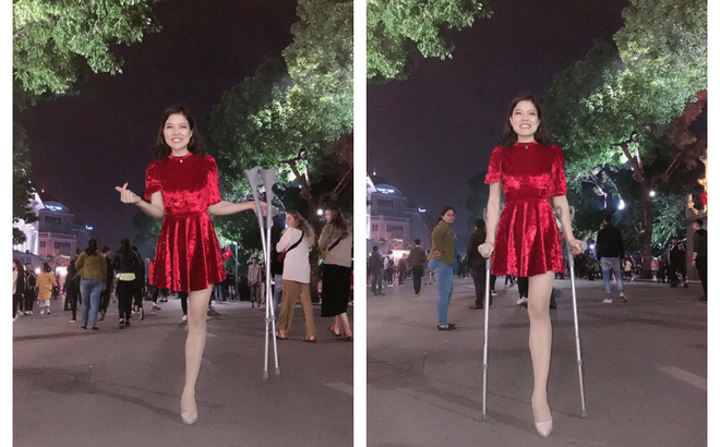 Cô gái mất 1 chân xuất hiện trên phố đi bộ Hà Nội gây xôn xao: Sau 4 ngày tỉnh lại đã thành người khác