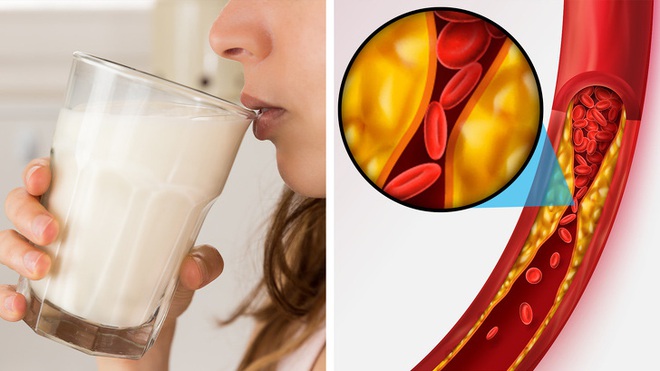 9 dấu hiệu bất thường của cơ thể cảnh báo bạn cần dừng ngay việc uống sữa - Ảnh 5.