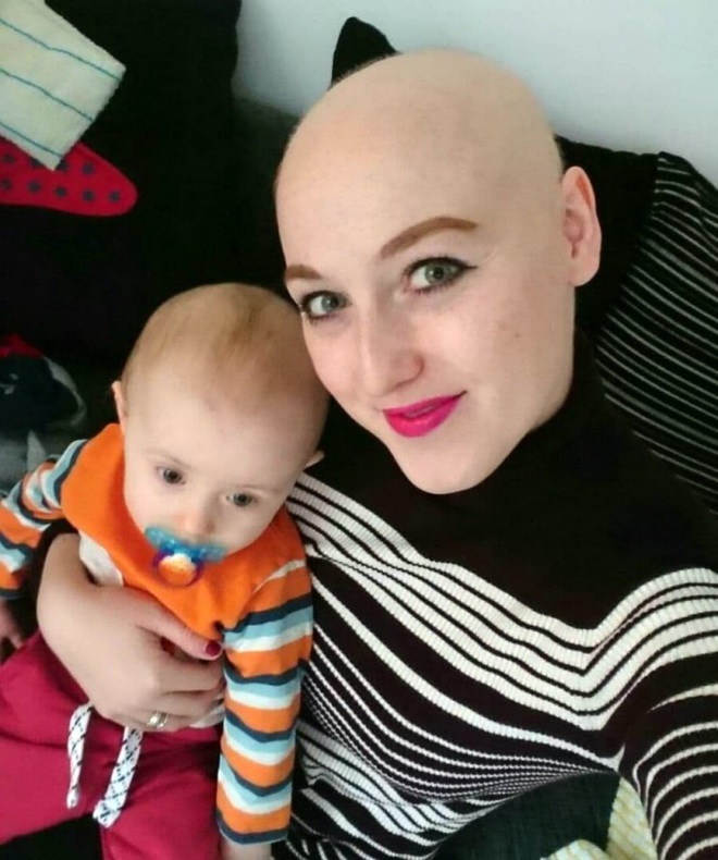 Câu chuyện của cô gái bị chẩn đoán ung thư vú sai và bị cắt cả 2 ngực - Ảnh 7.