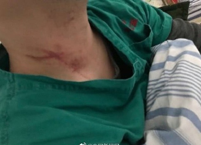 Không cứu sống được bệnh nhân nhiễm virus corona, 2 bác sĩ Vũ Hán bị đánh đập và xé áo bảo hộ cùng tâm sự nhói lòng của một nữ y tá - Ảnh 1.