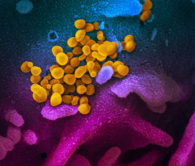 Mỹ hy vọng sớm sản xuất và thử nghiệm vaccine; châu Âu xác nhận ca đầu tiên tử vong do virus corona - Ảnh 2.