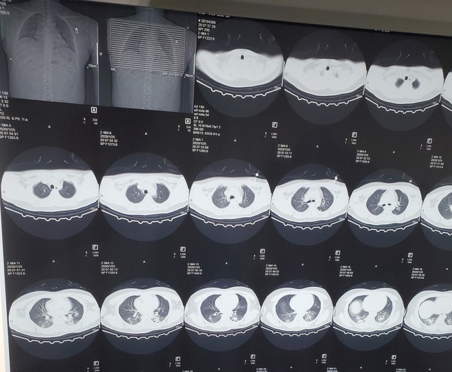 Chia sẻ của người sống sót về virus corona: Vào thời điểm đau đớn nhất, tôi đã nghĩ rằng mình sẽ chết ư? - Ảnh 2.