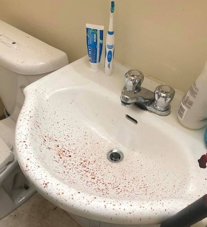 Vừa về tới nhà, người đàn ông ngửi thấy mùi hôi thối và nhà tắm đầy máu trước khi cơ quan chức năng phát hiện nguồn cơn từ nhà tầng trên - Ảnh 3.