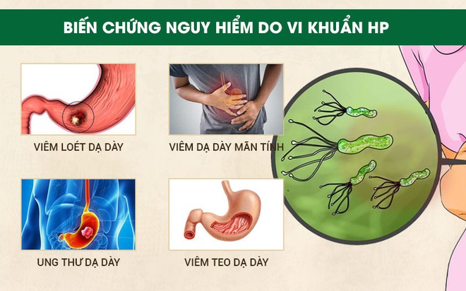 Phòng bệnh ung thư dạ dày: Khuyến cáo từ chuyên gia Bệnh viện K - Ảnh 2.