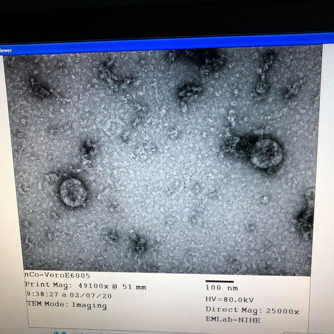 Phân lập virus corona là gì? Ý nghĩa như thế nào đối với tình hình dịch bệnh? - Ảnh 1.