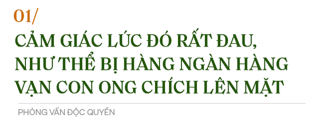 Phỏng vấn độc quyền: Nhĩ Thái phim Hoàn Châu Cách Cách trải lòng về cú sốc khiến mặt bị bỏng 50% - Ảnh 2.