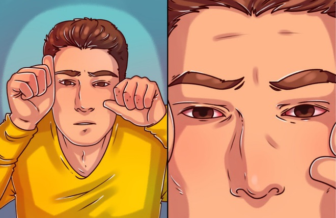 Bổ sung vitamin A ngay nếu cơ thể bạn xuất hiện 7 dấu hiệu này - Ảnh 7.