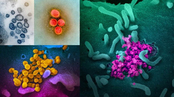 Virus SARS-CoV-2 có màu gì? - Ảnh 6.