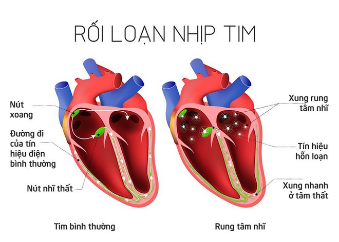 Tác hại của việc ăn no dưa hấu - Ảnh 2.