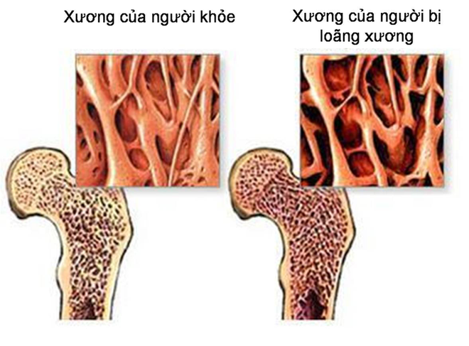 10 căn bệnh giết người thầm lặng mà bạn phải biết - Ảnh 5.