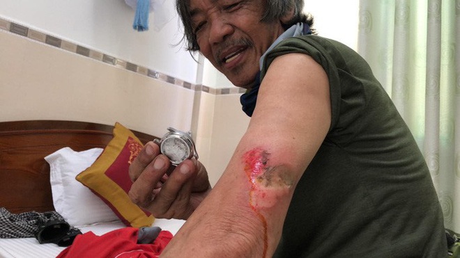 Nhà báo Dư Hải, Lê Nguyệt Minh và nhiều tay đua bị tai nạn giữa đèo - Ảnh 5.