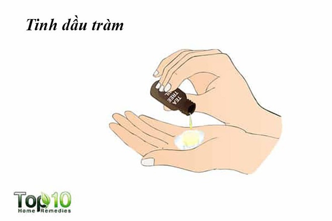 Làm thế nào để loại bỏ được mụn trên lưng và vai? - Ảnh 5.