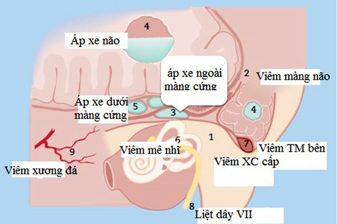 Tai có mùi hôi thối - triệu chứng của nhiều bệnh lý nguy hiểm - Ảnh 1.