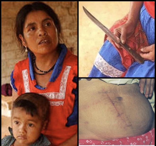 Đau đẻ nhưng không có ai bên cạnh giúp đỡ, bà mẹ đưa ra quyết định phi thường cứu sống con - Ảnh 2.