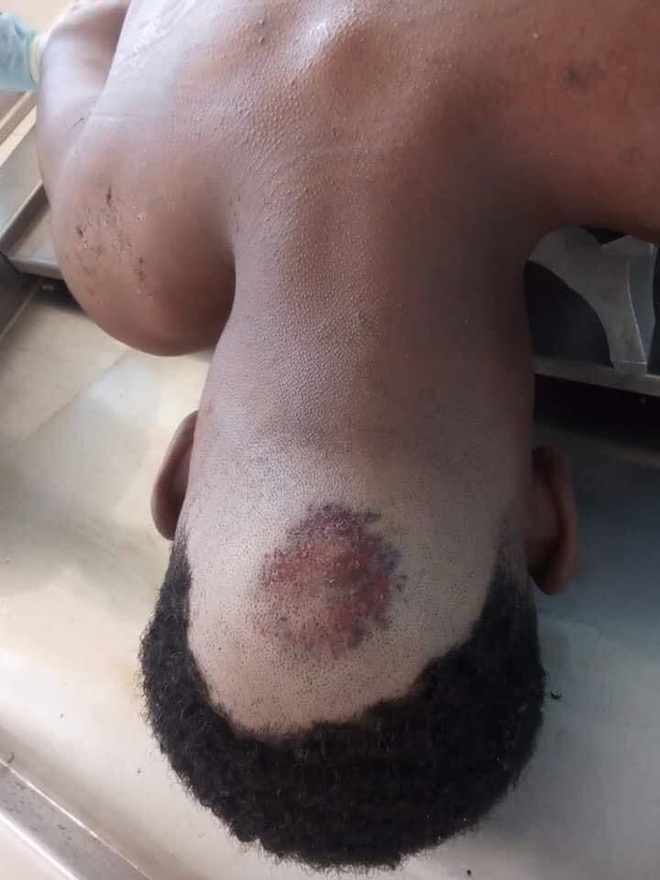 Nóng: Đấu sĩ tử vong sau màn đánh đường phố khiến làng võ Việt xôn xao - Ảnh 3.