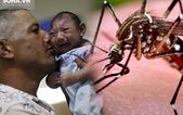 Tất cả về virus Zika - virus "ăn não trẻ em"