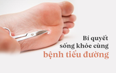 Người bị tiểu đường có thể "thảnh thơi" sống khỏe đến già nếu áp dụng công thức 69834