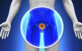 [Cẩm nang] Nếu xuất hiện các dấu hiệu này khi đi tiểu, có thể cơ thể đang có "mầm" ung thư