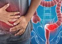 3 thói quen giúp giảm tới 90% nguy cơ mắc ung thư: Đơn giản đến mức ai cũng làm được