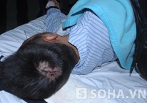 Bản tin thời sự sáng 10/1: Lời kể kinh hoàng của sinh viên bị chém vỡ sọ