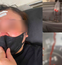 Dừng xe nghe điện thoại, người phụ nữ bị đánh giữa phố Hà Nội bằng gậy sắt: Nguyên nhân được tiết lộ