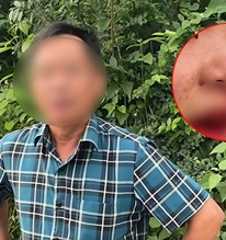 Vụ cô gái tố tài xế ô tô hành hung chảy máu mồm: Người đánh là cán bộ xã