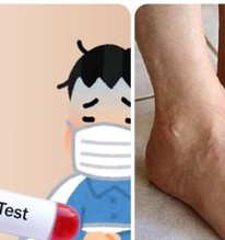Cách đào thải axit uric ra khỏi cơ thể nhanh nhất