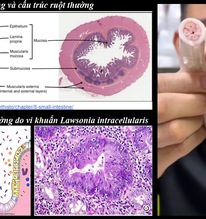 Tiến sĩ Việt tại Mỹ tiết lộ sự thật về lòng xe điếu, cảnh báo 3 nguy cơ
