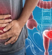 Bác sĩ Bạch Mai hé lộ “hạt giống” khởi nguồn cho ung thư, khuyên làm 1 việc để loại bỏ 90% nguy cơ