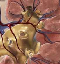 8 dấu hiệu suy thận giai đoạn đầu bạn không nên bỏ qua