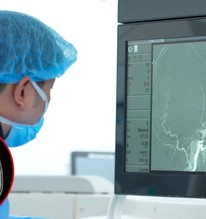 Đi tầm soát đột quỵ, người phụ nữ "sốc" khi nhìn vào ảnh chụp MRI