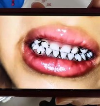 233 trẻ mầm non ở Thiên Thủy nhiễm độc chì nặng: Lộ tẩy sự thật kinh hoàng về nguyên liệu làm bánh